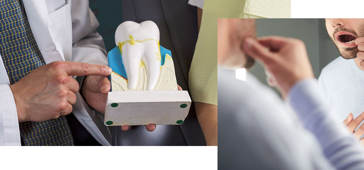 Man pointing at a dental model. Inset of man looking in his mouth.