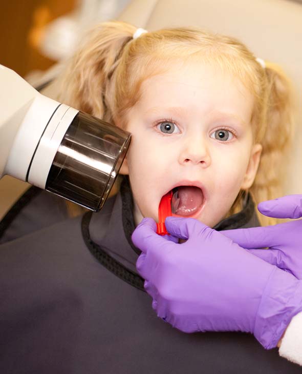 Little girl with mouth open to get X-ray.